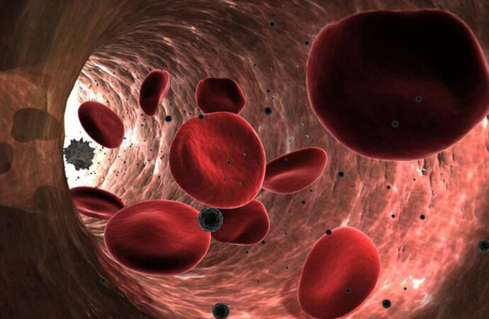 Descubren por primera vez microplásticos en los vasos sanguíneos humanos