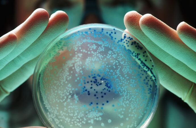 <strong>La OMS advierte de una “pandemia silenciosa” causada por bacterias resistentes a los antibióticos</strong>