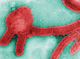 <strong>EE. UU. despliega expertos para combatir la mortal enfermedad por el virus de Marburgo en África</strong>