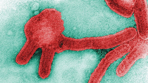 <strong>EE. UU. despliega expertos para combatir la mortal enfermedad por el virus de Marburgo en África</strong>